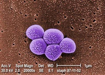 MRSA Bacteria Photo